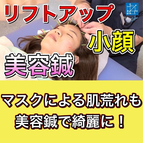 東京で人気の美容鍼の効果ブログ.jpg
